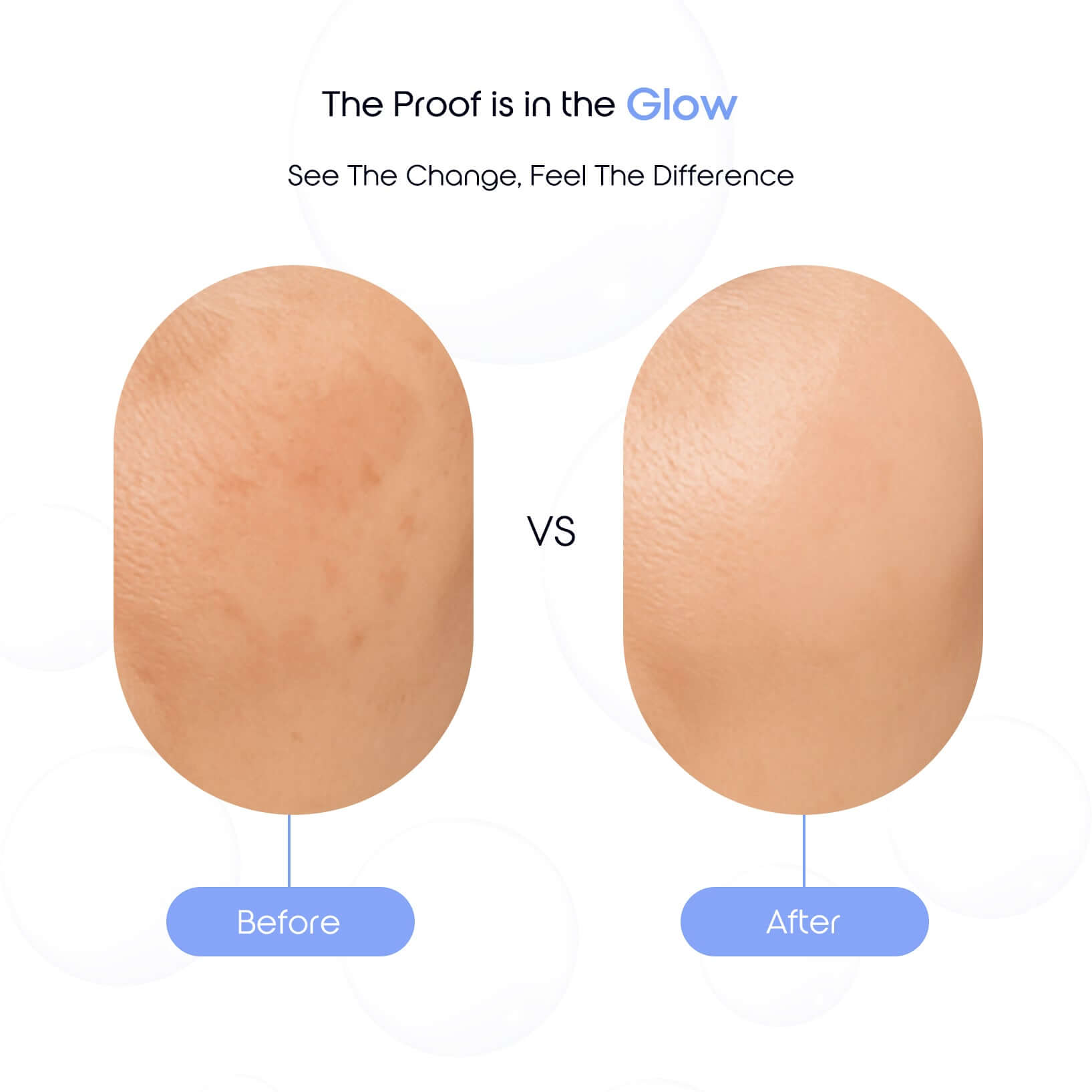 Before and after comparison showing reduced pigmentation and improved skin tone after using Turmeric Glow Face Serum