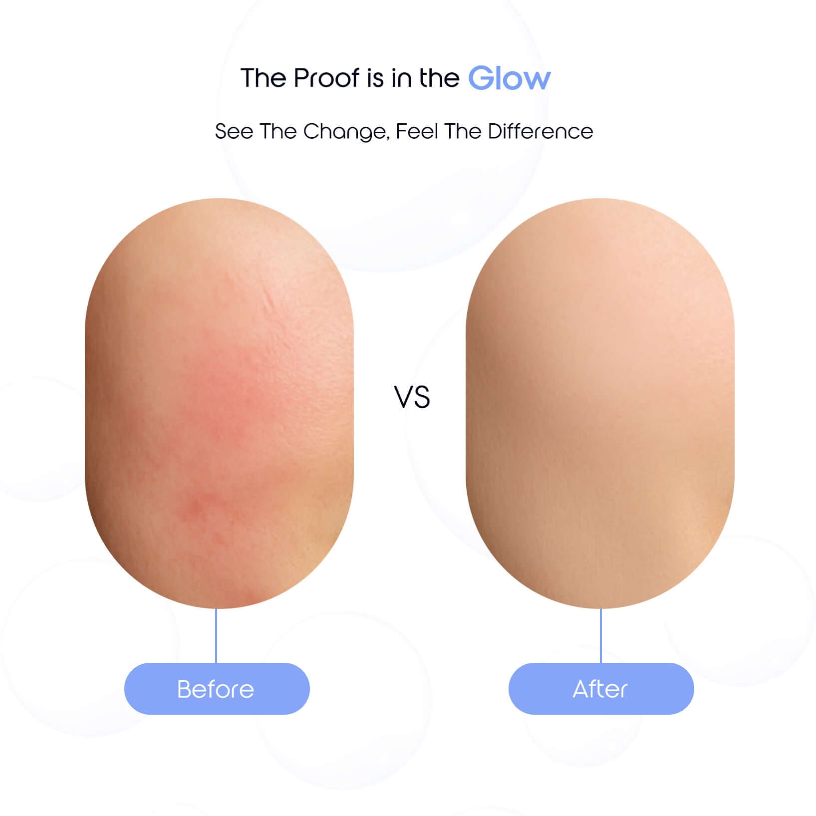 Before and after comparison showing reduced redness and smoother skin after using Calm Cloud Cleanser