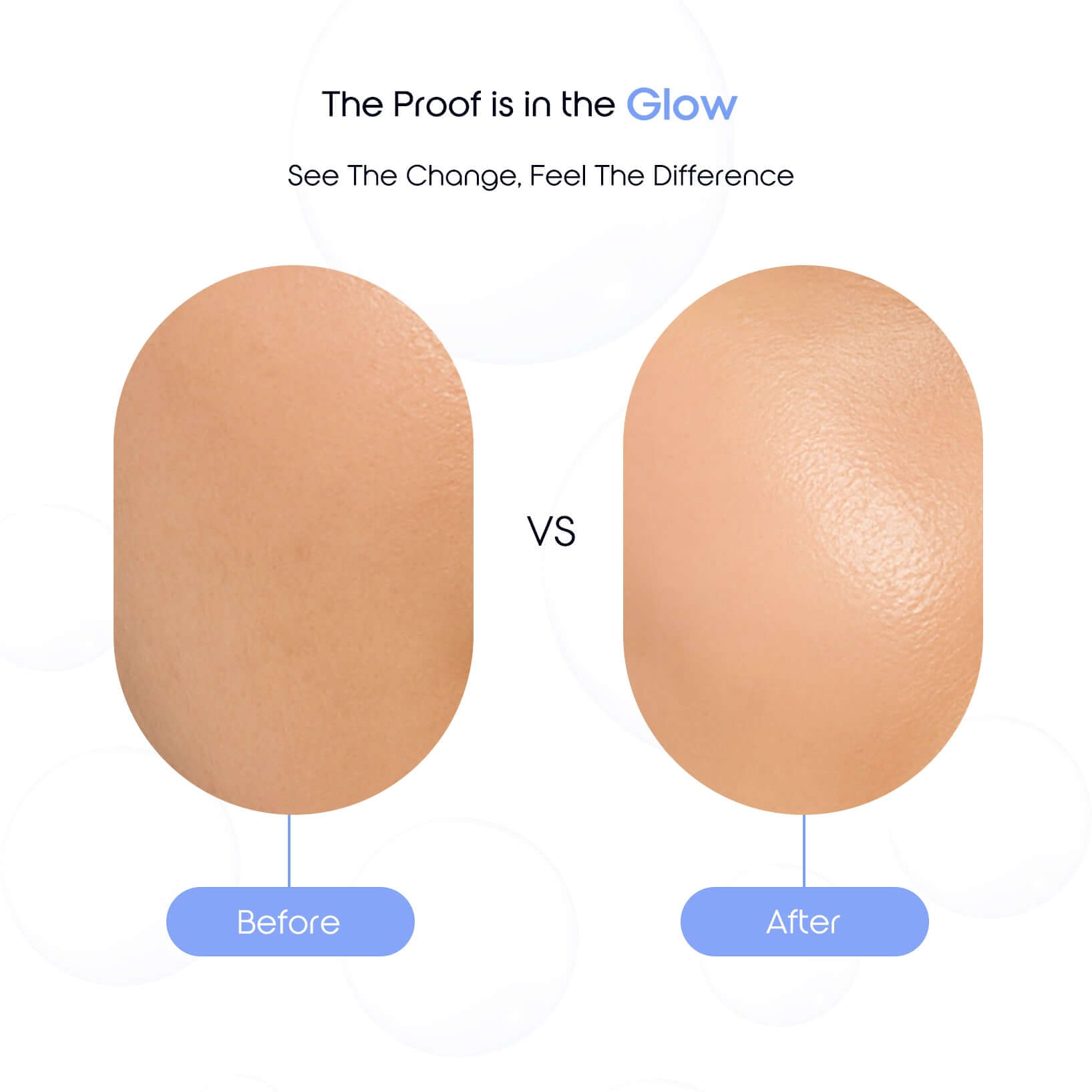 Skin transformation before and after using Willingly Vitamin C Face Serum showing improved glow