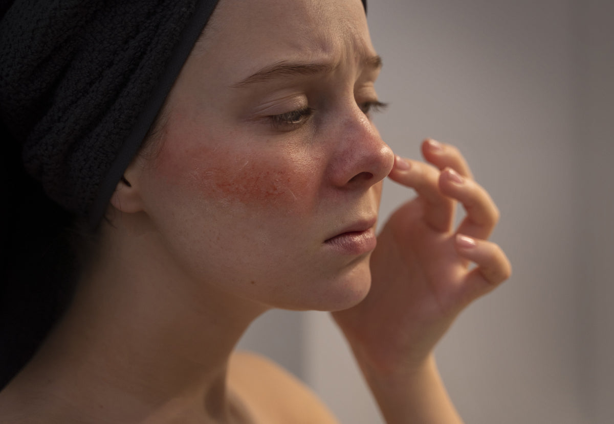 Sensitive Skin (Reactive Skin)